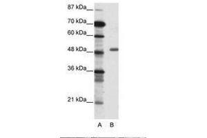 Image no. 1 for anti-Transcriptional Adaptor 3 (TADA3) (AA 156-205) antibody (ABIN6736087)