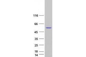 Validation with Western Blot (BAG5 Protein (Transcript Variant 3) (Myc-DYKDDDDK Tag))