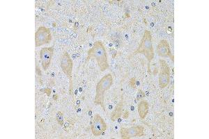 Immunohistochemistry of paraffin-embedded mouse brain using EPHA2 Antibody. (EPH Receptor A2 antibody  (AA 847-976))