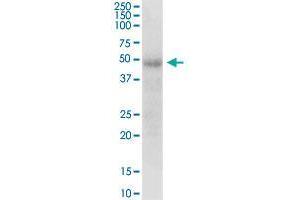 Western Blotting (WB) image for anti-Docking Protein 1, 62kDa (Downstream of tyrosine Kinase 1) (DOK1) (AA 1-481) antibody (ABIN515056)