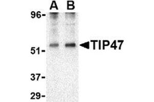 Western blot analysis of TIP47 in EL4 cell lysate with this product at (A) 0. (PLIN3 antibody  (N-Term))