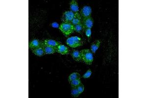 IF analysis of HYI using anti-HYI antibody (ABIN7601796). (HYI antibody  (AA 46-277))
