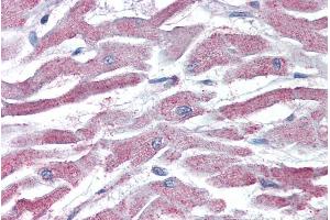 Immunohistochemistry (IHC) image for anti-V-Akt Murine Thymoma Viral Oncogene Homolog 3 (Protein Kinase B, Gamma) (AKT3) (AA 119-133) antibody (ABIN185314)