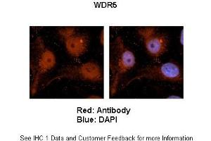 Sample Type :  Human brain stem cells (NT2)   Primary Antibody Dilution :   1:500  Secondary Antibody :  Goat anti-rabbit Alexa Fluor 594  Secondary Antibody Dilution :   1:1000  Color/Signal Descriptions :  Red: WDR5 Blue: DAPI  Gene Name :  WDR5  Submitted by :  Dr. (WDR5 antibody  (C-Term))