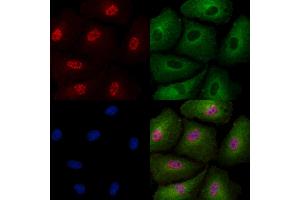 Phospho-SIRT6 (Thr294) Antibody staining A549 cells(4h of LPS treatment) by IF/ICC.