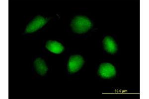 Immunofluorescence of purified MaxPab rabbit antibody to STK11 on HeLa cell. (LKB1 antibody  (AA 1-433))