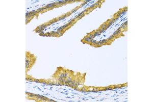 Immunohistochemistry of paraffin-embedded human prostate using BTD antibody at dilution of 1:100 (40x lens). (BTD antibody)