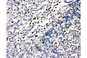 Anti-FLI1 antibody, IHC(P) IHC(P): Human Tonsil Tissue (FLI1 antibody  (N-Term))