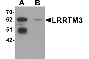 Western Blotting (WB) image for anti-Leucine Rich Repeat Transmembrane Neuronal 3 (LRRTM3) (C-Term) antibody (ABIN1030498) (LRRTM3 antibody  (C-Term))