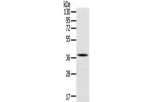 Western Blotting (WB) image for anti-Secreted Protein, Acidic, Cysteine-Rich (Osteonectin) (SPARC) antibody (ABIN2422187)