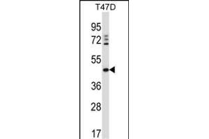 DEGS1 anticorps  (N-Term)