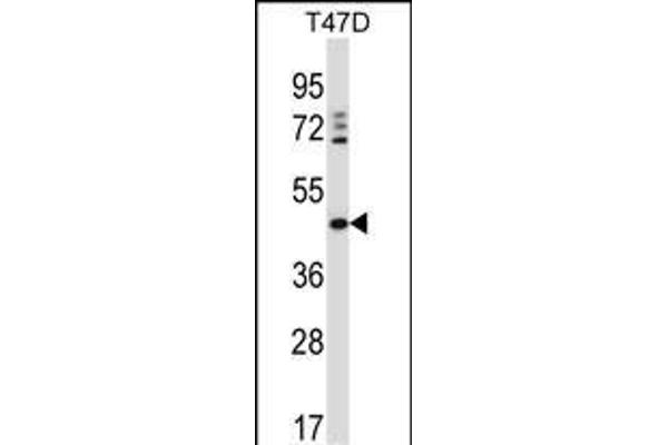 DEGS1 antibody  (N-Term)