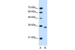 Image no. 1 for anti-Activin A Receptor, Type IIB (ACVR2B) (C-Term) antibody (ABIN6736679) (ACVR2B antibody  (C-Term))