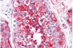 Human Testis: Formalin-Fixed, Paraffin-Embedded (FFPE) (ADAM20 antibody  (Internal Region))