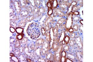 Paraformaldehyde-fixed, paraffin embedded rat kidney; Antigen retrieval by boiling in sodium citrate buffer (pH6. (MAP1B antibody  (AA 451-550))