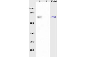 Lane 1: rat kydney lysates Lane 2: rat brain lysates probed with Anti PAP-? (PAPOL A+B+G antibody)