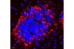 Immunofluorescence of paraffin embedded mouse epencephalon using AMIGO2 (ABIN7072966) at dilution of 1: 1300 (400x lens) (AMIGO2 antibody)