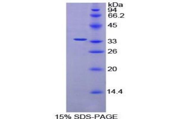 AMY2 Protein