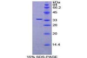 SDS-PAGE analysis of Rat AMY2 Protein. (AMY2 Protein)