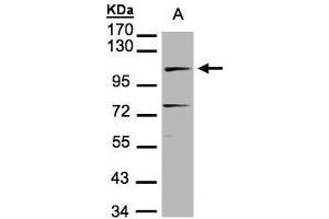 WB Image Sample(30 μg of whole cell lysate) A:MOLT4, 7. (LIG4 antibody)