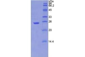 SDS-PAGE analysis of Human PSA Protein.