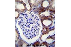CASP3 Antibody (C-term) immunohistochemistry analysis in formalin fixed and paraffin embedded human kidney tissue followed by peroxidase conjugation of the secondary antibody and DAB staining. (Caspase 3 antibody  (C-Term))