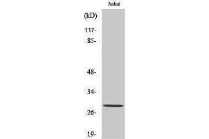 Western Blotting (WB) image for anti-Glutathione S-Transferase theta 1/4 (GSTT1/4) (N-Term) antibody (ABIN3184959) (GSTT1/4 antibody  (N-Term))