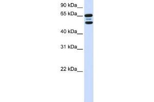 WB Suggested Anti-FBXO21 Antibody Titration:  0.