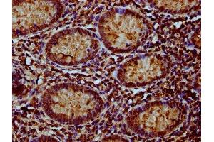 IHC image of ABIN7160882 diluted at 1:100 and staining in paraffin-embedded human appendix tissue performed on a Leica BondTM system. (NDUFAF3 antibody  (AA 91-184))