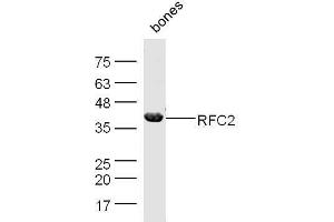 Mouse bone lysates probed with Rabbit Anti-RFC2 Polyclonal Antibody, Unconjugated  at 1:500 for 90 min at 37˚C.