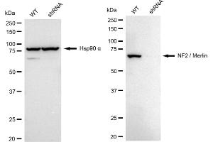 Western blotting analysis using NF2 / Merlin antibody (ABIN7799579).