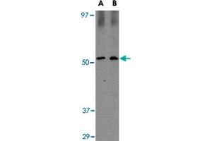Western blot analysis of SIRT2 in Mouse brain tissue lysate with SIRT2 polyclonal antibody  at (A) 1 and (B) 2 ug/mL . (SIRT2 antibody  (C-Term))