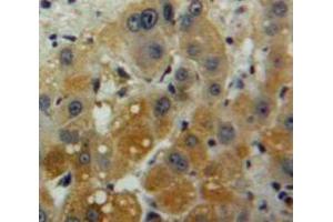 Used in DAB staining on fromalin fixed paraffin-embedded Liver tissue (IFNA2 antibody  (AA 24-188))