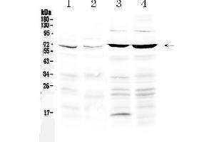 Western blot analysis of PPAR gamma using anti-PPAR gamma antibody . (PPARG antibody  (Middle Region))