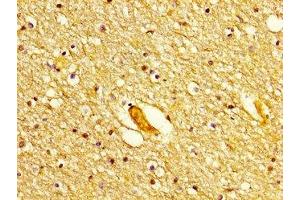IHC image of ABIN7150227 diluted at 1:300 and staining in paraffin-embedded human brain tissue performed on a Leica BondTM system. (POLD1 antibody  (Catalytic Subunit))