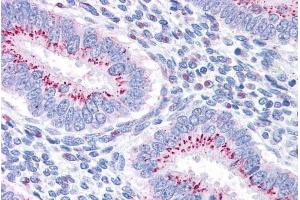 ABIN184847 (3. (GOLM1 antibody  (C-Term))