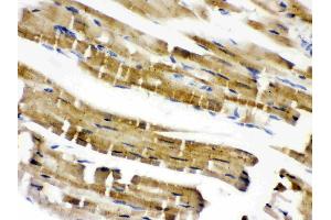 Cofilin 2 was detected in paraffin-embedded sections of mouse cardiac muscle tissues using rabbit anti- Cofilin 2 Antigen Affinity purified polyclonal antibody (Catalog # ) at 1 µg/mL. (Cofilin 2 antibody  (C-Term))