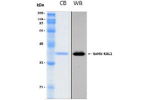 10% SDS-PAGE stained with Coomassie Blue (CB), immunobloting with anti-6His (WB) and peptide fingerprinting by MALDI-TOF mass spectrometry (KAL1 Protein (AA 384-680) (His tag))