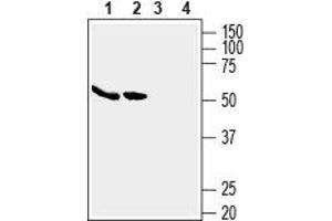 Western blot analysis of human MCF-7 breast adenocarcinoma cell lysates (lanes 1 and 3) and human Caco-2 colon adenocarcinoma cell lysates (lanes 2 and 4): - 1,2. (SLC2A5 antibody  (C-Term, Intracellular))
