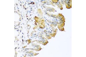 Immunohistochemistry of paraffin-embedded mouse lung using VTN antibody at dilution of 1:100 (40x lens).
