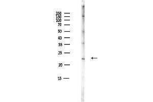 anti-Potassium Large Conductance Calcium-Activated Channel, Subfamily M, beta Member 1 (KCNMB1) (Internal Region) antibody