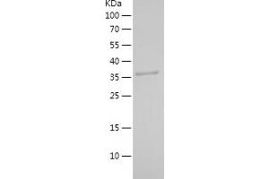 Western Blotting (WB) image for Hydroxysteroid Dehydrogenase Like 2 (HSDL2) (AA 212-363) protein (His-IF2DI Tag) (ABIN7282377) (HSDL2 Protein (AA 212-363) (His-IF2DI Tag))