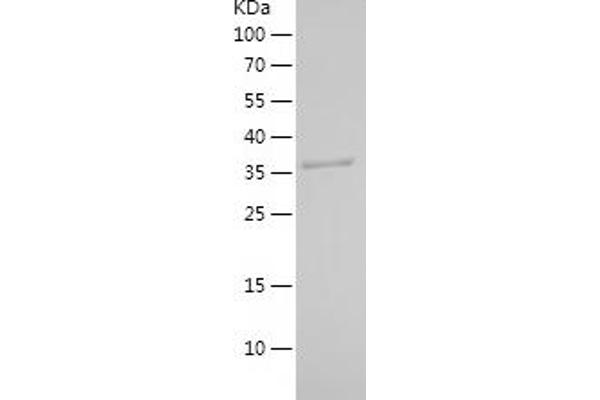 HSDL2 Protein (AA 212-363) (His-IF2DI Tag)