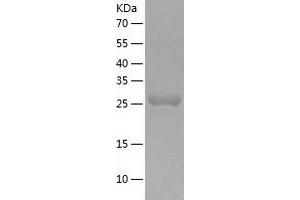 Western Blotting (WB) image for DCN1, Defective in Cullin Neddylation 1, Domain Containing 4 (DCUN1D4) (AA 1-292) protein (His tag) (ABIN7288179) (DCUN1D4 Protein (AA 1-292) (His tag))