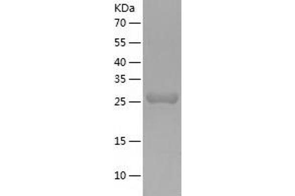 DCUN1D4 Protein (AA 1-292) (His tag)