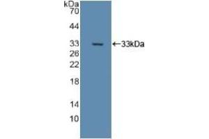 Detection of Recombinant DLD, Rat using Polyclonal Antibody to Dihydrolipoyl Dehydrogenase (DLD) (DLD antibody)
