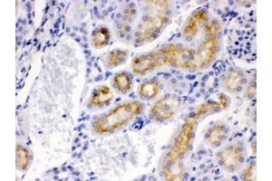IHC testing of FFPE mouse kidney with CYP24A1 antibody.