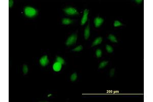 Immunofluorescence of purified MaxPab antibody to STK3 on HeLa cell. (STK3 antibody  (AA 1-491))