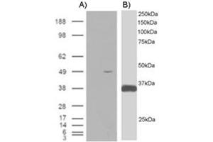 Image no. 1 for anti-STE20-Related Kinase Adaptor beta (STRADB) (C-Term) antibody (ABIN374305) (STRADB antibody  (C-Term))