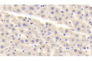 Detection of MAOA in Rat Liver Tissue using Polyclonal Antibody to Monoamine Oxidase A (MAOA) (Monoamine Oxidase A antibody  (AA 2-497))